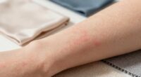fabric sensitivity and reactions