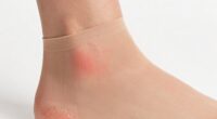 hosiery fit skin issues